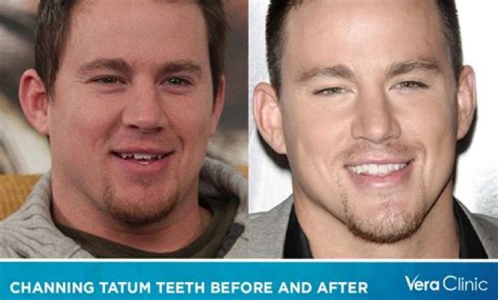 Unveiling Channing Tatum's Dance Legacy: Insights And Discoveries